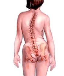 Pathologie vum Muskulascheletal System