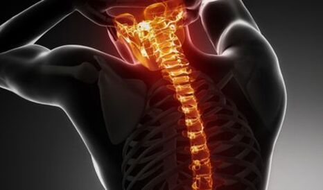 Osteochondrosis vun der ganzer Wirbelsäit