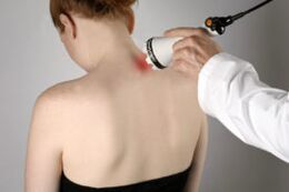Behandlung vu Gebärmutteral Osteochondros mat Laser Therapie